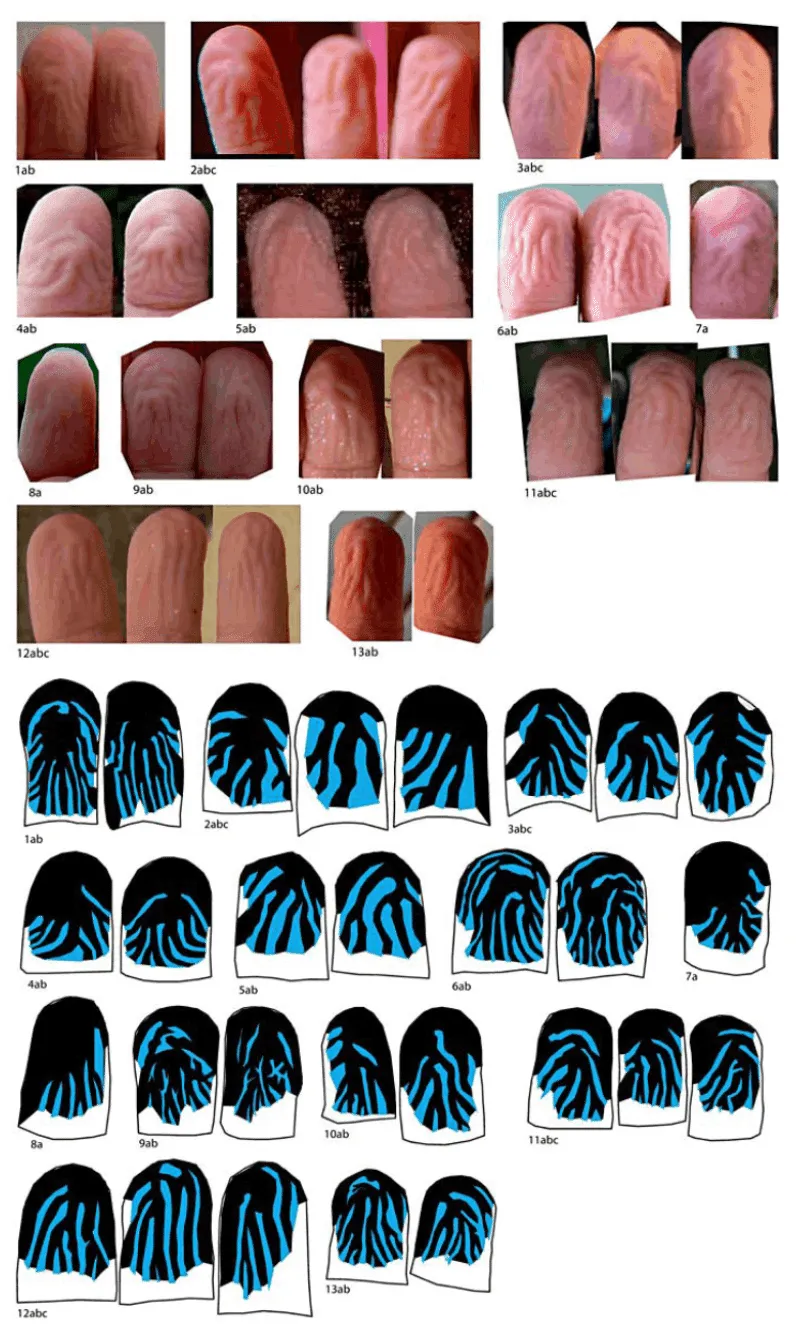 図2 Changizi et al. (2011) Fig.4., Fig.5. より引用。13人の被験者の指のシワを観察した。青が谷を示しており、Promontory ネットワークの構造の特徴が見られる。すなわち、シワのくぼみが、指先 (頂上) から遠くなるほど発散する傾向が見られる。